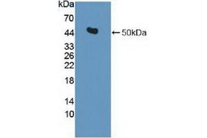 Detection of Recombinant IDH2, Human using Polyclonal Antibody to Isocitrate Dehydrogenase 2, mitochondrial (IDH2) (IDH2 Antikörper  (AA 40-452))