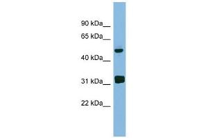LYAR antibody used at 1 ug/ml to detect target protein. (LYAR Antikörper)