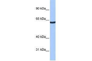WB Suggested Anti-ZNF350 Antibody Titration:  0. (ZNF350 Antikörper  (N-Term))