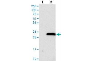 Western blot analysis of Lane 1: Negative control (vector only transfected HEK293T lysate), Lane 2: Over-expression Lysate (Co-expressed with a C-terminal myc-DDK tag (~3. (PIGX Antikörper)