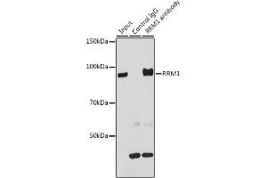 Immunoprecipitation (IP) image for anti-Ribonucleotide Reductase M1 (RRM1) (AA 593-792) antibody (ABIN3021563)