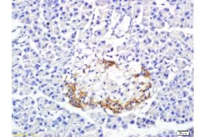 Formalin-fixed and paraffin embedded rat pancreas labeled with Anti-SREBP-1 Polyclonal Antibody, Unconjugated (ABIN686032) followed by conjugation to the secondary antibody and DAB staining (Srebp-1/2 (AA 301-450) Antikörper)