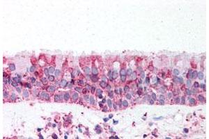 Immunohistochemistry (Formalin/PFA-fixed paraffin-embedded sections) of human trachea tissue with TRPV4 polyclonal antibody . (TRPV4 Antikörper  (N-Term))