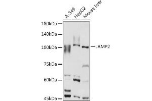 Western blot analysis of extracts of various cell lines, using L antibody (ABIN6129969, ABIN6143081, ABIN6143082 and ABIN6218224) at 1:1000 dilution. (LAMP2 Antikörper  (AA 30-300))
