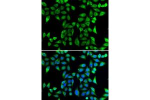 Immunofluorescence analysis of U20S cell using DNAJA3 antibody. (DNAJA3 Antikörper)