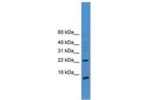 Image no. 1 for anti-Prostate Stem Cell Antigen (PSCA) (AA 51-100) antibody (ABIN6745361) (PSCA Antikörper  (AA 51-100))