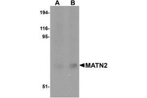 Western Blotting (WB) image for anti-Matrilin 2 (MATN2) (C-Term) antibody (ABIN1030508) (MATN2 Antikörper  (C-Term))