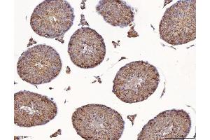 IHC analysis of Calmegin/CLGN using anti-Calmegin/CLGN antibody (ABIN7601481). (Calmegin Antikörper  (AA 36-610))