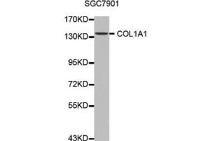 Western blot analysis of extracts of SGC7901 cell line, using COL1A1 antibody. (COL1A1 Antikörper)