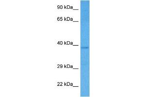 Host:  Rabbit  Target Name:  SMARCB1  Sample Tissue:  Human HCT15 Whole Cell lysates  Antibody Dilution:  1ug/ml (SMARCB1 Antikörper  (Middle Region))