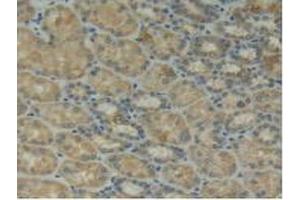 Figure. (ITGAD Antikörper  (AA 879-1099))