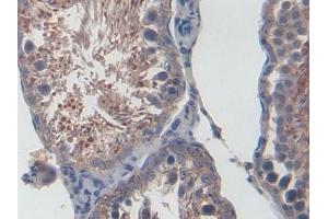 DAB staining on IHC-P; Samples: Rat Testis Tissue (CXCL1 Antikörper  (AA 25-96))