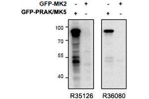 Western blot of HEK293 lysate overexpressing mouse MK5/PRAK (first lane) or mouse MK2 (second lane) tested with right ) PRAK antibody (cat # R36080, 0. (MAPKAP Kinase 5 Antikörper)