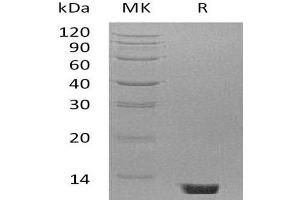 Western Blotting (WB) image for Complement Component 5 (C5) protein (ABIN7320495) (C5 Protein)