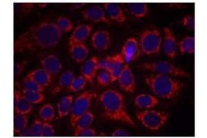Immunofluorescence staining of methanol-fixed MCF7 cells using CD340 / ERBB2 / HER2 Antibody (pTyr1248) (ErbB2/Her2 Antikörper  (pTyr1248))