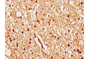 IHC image of nhibHU diluted at 1:20 and staining in paraffin-embedded human brain tissue performed on a Leica BondTM system. (HIST1H1C Antikörper  (AA 82-94))