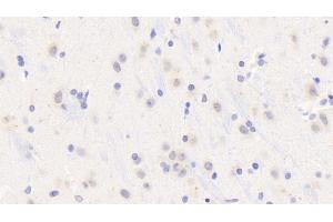 Detection of MyD88 in Rat Cerebrum Tissue using Polyclonal Antibody to Myeloid Differentiation Factor 88 (MyD88) (MYD88 Antikörper  (AA 1-296))