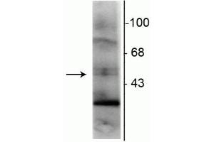 Western blot of rat hippocampal lysate showing specific immunolabeling of the ~48 kDa RXR-γ isotype. (Retinoid X Receptor gamma Antikörper)