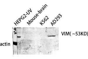 Western Blot (WB) analysis of HepG2-UV Mouse Brain AD293 K562 cells using VIM Polyclonal Antibody. (Vimentin Antikörper  (C-Term))
