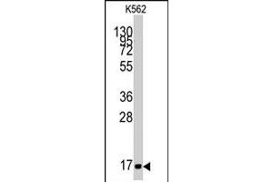 Western blot analysis of MGST1 polyclonal antibody  in K-562 cell line lysates (35 ug/lane).