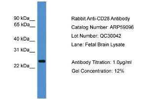 WB Suggested Anti-CD28  Antibody Titration: 0. (CD28 Antikörper  (C-Term))