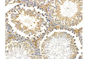 ABIN6259310 and ABIN6274936 at 1/100 staining Rat testis tissue by IHC-P. (PNPLA8 Antikörper  (C-Term))
