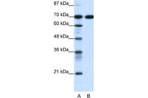 Human Jurkat; WB Suggested Anti-RRN3 Antibody Titration: 0.