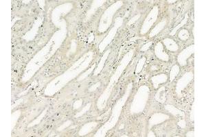 ABIN6259777 and ABIN6277561 at 1/100 staining human normal kidney tissue by IHC-P. (ADAM9 Antikörper  (C-Term))