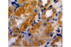 Immunohistochemistry (Paraffin-embedded Sections) (IHC (p)) image for anti-ADAM Metallopeptidase with Thrombospondin Type 1 Motif, 1 (ADAMTS1) (AA 854-967) antibody (ABIN2906550)