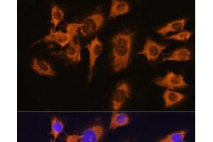 Immunofluorescence analysis of C6 cells using SLC20A1 Polyclonal Antibody at dilution of 1:100. (SLC20A1 Antikörper)