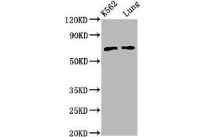 Western Blot Positive WB detected in: K562 whole cell lysate, Rat lung tissue All lanes: POF1B antibody at 3.