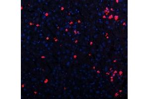 IF analysis of CXCL12 using anti-CXCL12 antibody (ABIN6719467).