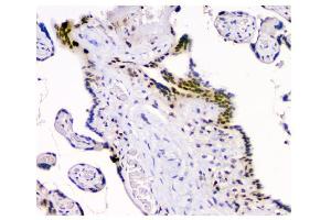 IHC analysis of HAUSP/USP7 using anti-HAUSP/USP7 antibody (ABIN6719603). (USP7 Antikörper  (AA 258-483))