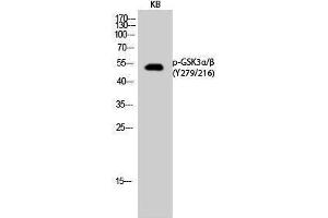 Western Blotting (WB) image for anti-Glycogen Synthase Kinase 3 alpha/beta (GSK3a/b) (pTyr216), (pTyr279) antibody (ABIN3179444) (GSK3 alpha/beta Antikörper  (pTyr216, pTyr279))
