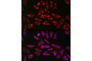 Immunofluorescence (IF) image for anti-Galactosidase, beta 1 (GLB1) (AA 1-270) antibody (ABIN3015643)