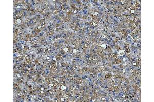 IHC analysis of BI-1/TMBIM6 using anti-BI-1/TMBIM6 antibody (ABIN7603199). (Bax Inhibitor 1 Antikörper  (N-Term))