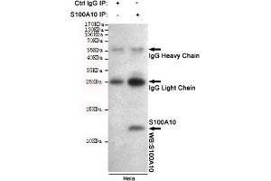 Immunoprecipitation analysis of Hela cell lysates using S100A10 mouse mAb.