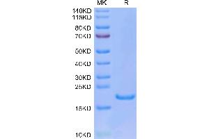 Human IL-33 on Tris-Bis PAGE under reduced condition. (IL-33 Protein (AA 112-270))