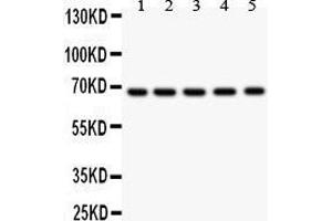 Anti- HNF1 antibody, Western blotting All lanes: Anti HNF1  at 0. (HNF1A Antikörper  (AA 431-631))