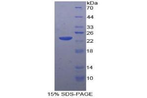 SDS-PAGE analysis of Rabbit MMP12 Protein.