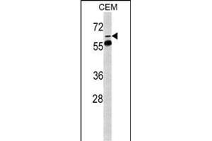Western blot analysis of FKBP10 Antibody (N-term) (ABIN391572 and ABIN2841509) in CEM cell line lysates (35 μg/lane). (FKBP10 Antikörper  (AA 57-87))