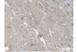 IHC-P analysis of Rat Heart Tissue, with DAB staining. (CES1 Antikörper  (AA 19-300))