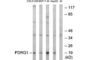 Western blot analysis of extracts from Jurkat/COLO/MCF-7/HepG2 cells, using PDRG1 Antibody. (PDRG1 Antikörper  (AA 58-107))
