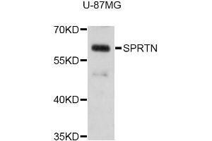 Western blot analysis of extracts of U-87MG cells, using SPRTN Antibody (ABIN5998940) at 1:3000 dilution. (Spartan Antikörper)