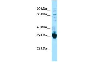 Host: Rabbit Target Name: Fibcd1 Sample Type: Mouse Lung lysates Antibody Dilution: 1. (FIBCD1 Antikörper  (C-Term))