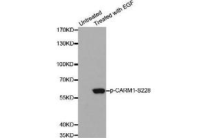 Western blot analysis of extracts from A431 cells using Phospho-CARM1-S228 antibody. (CARM1 Antikörper  (pSer228))