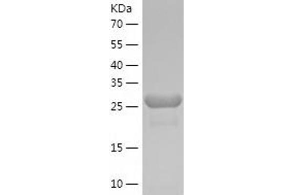 EYA2 Protein (AA 244-514) (His tag)