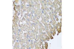 Immunohistochemistry (IHC) image for anti-SET Nuclear Oncogene (SET) antibody (ABIN1882339)