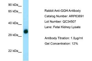 Western Blotting (WB) image for anti-gamma-Glutamyl Hydrolase (Conjugase, Folylpolygammaglutamyl Hydrolase) (GGH) (C-Term) antibody (ABIN2789590)