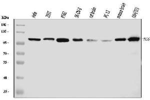 Western blot analysis of HGS using anti-HGS antibody (ABIN6719534).